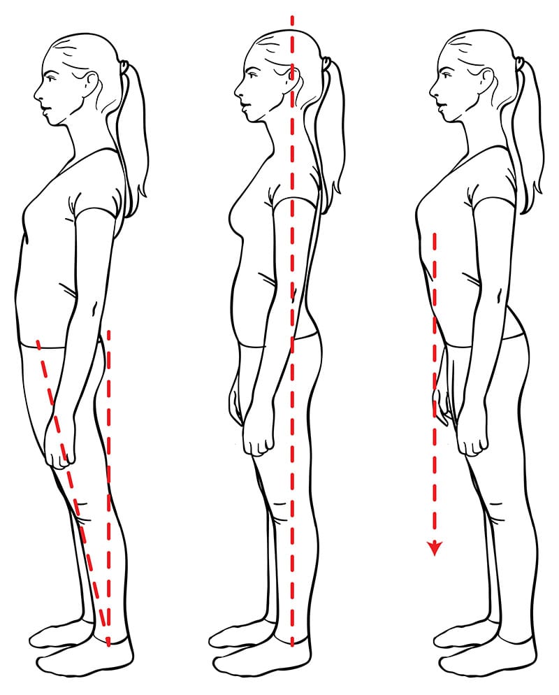Figures showing different body alignment - sway back, optimal, rib thrust